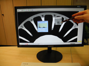 Digital Radiograph on Monitor Screen
